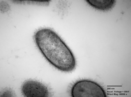 Corynebacterium mayonis bacteria