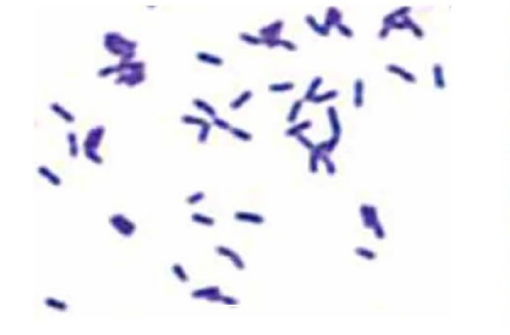 BD556T stains Gram-positive