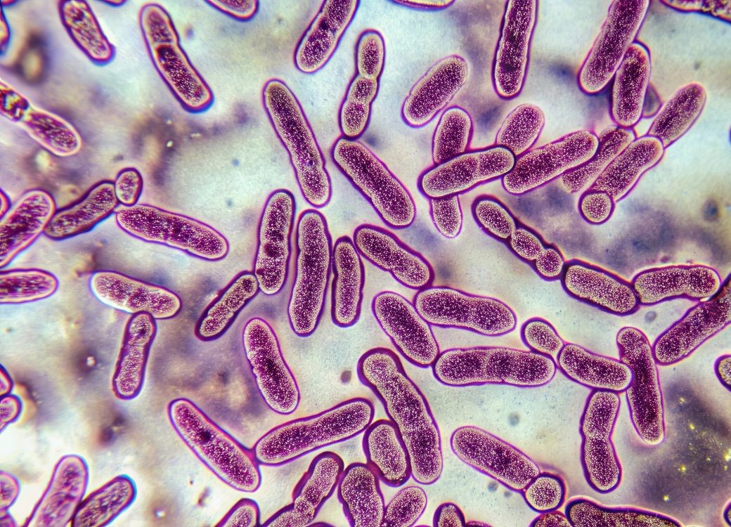 Mycobacterium tuberculosis