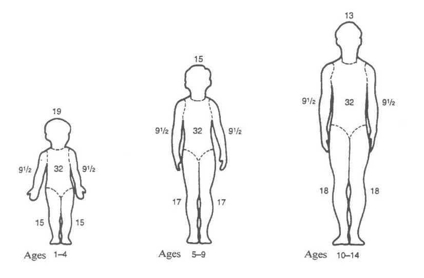 Pediatric Burn Percentage Chart