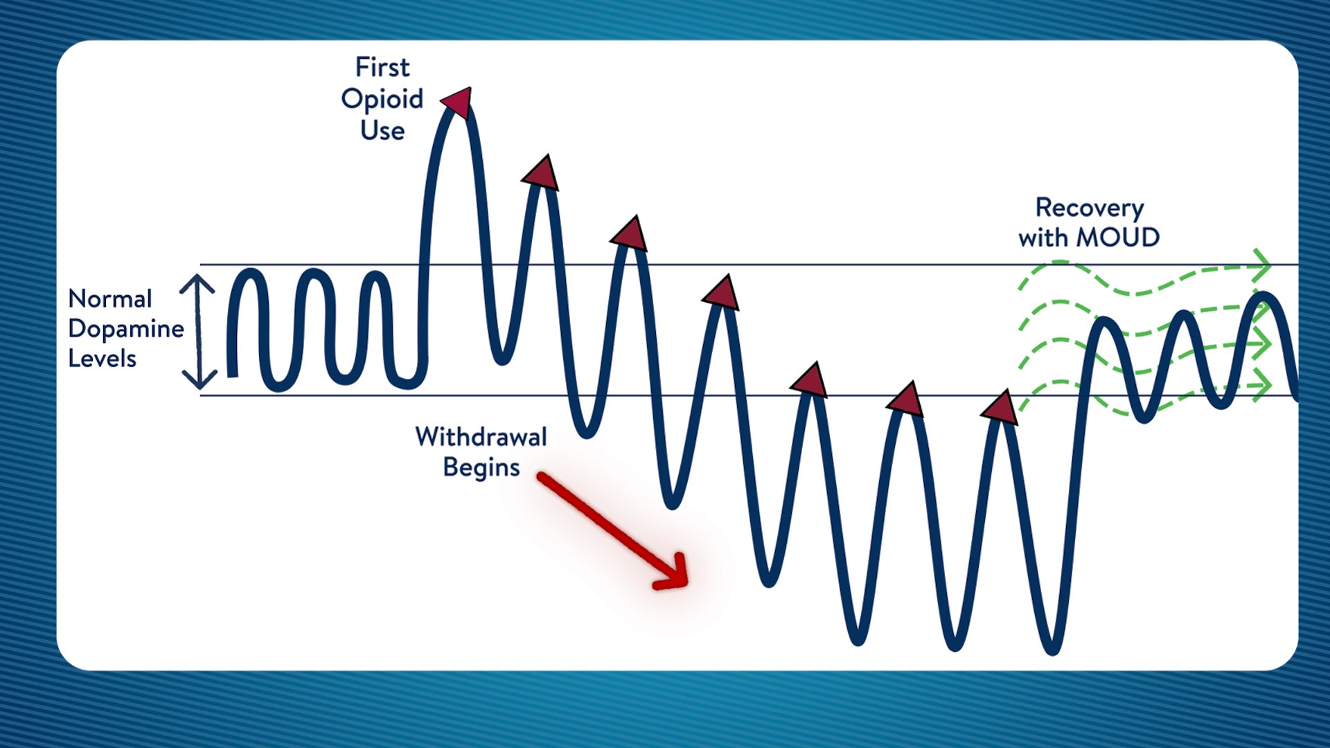 Chart showing how dopamine levels in the brain are affected by withdrawal.