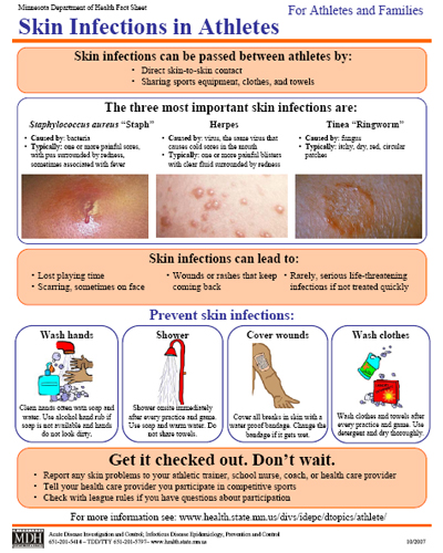 Skin Infections Information For Athletes And Families Mn Dept Of Health