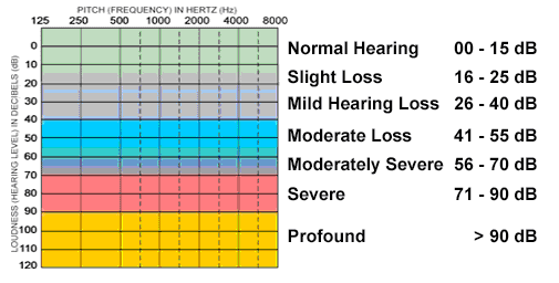 Hearing Loss Range Chart