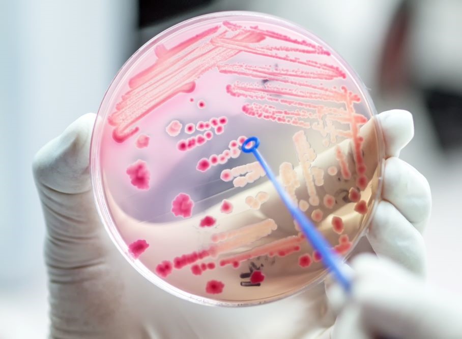 Antibiotic resistance plate